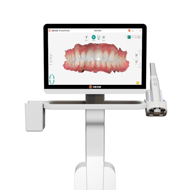 Scanbild mit Farbtonerfassung des DEXIS IS 3800